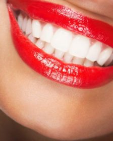 teeth-whitening-beautifuljobs