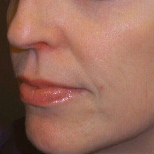What Are TriBella™ Facial Rejuvenation Treatments?beautiful jobs