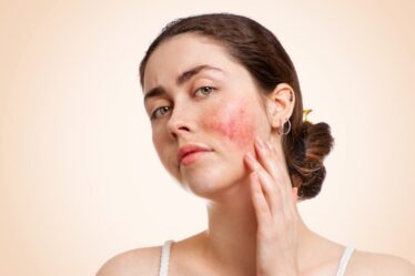 Calm the Curse of the Celts: Yon-Ka’s targeted skincare solutions for rosacea-prone skin-BEAUTIFULJOBS